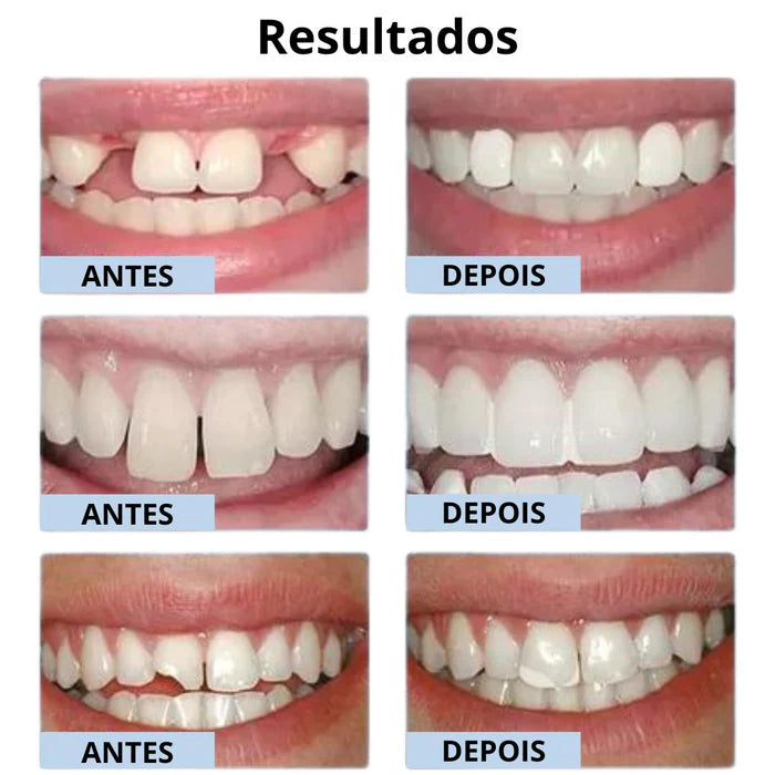 [COMPRE 1 LEVE 2] Restaurador de Dentes False Teeth - Volte A Sorrir!