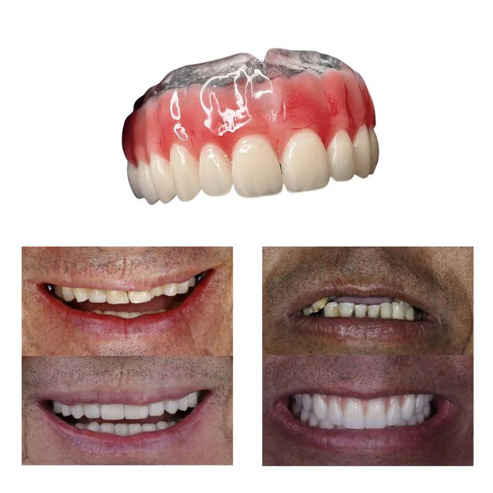 Dentadura Universal NewSmile | Ajustável e Adaptativel (Compre 1 Peça leve 2)