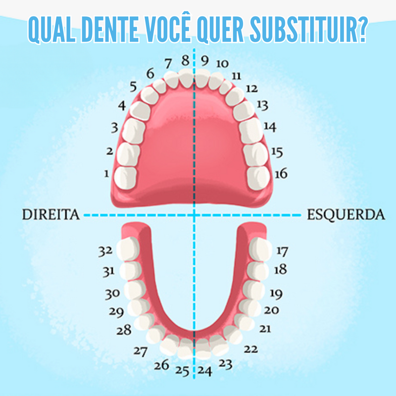 Prótese Parcial Removível - Preencha Suas Falhas [FRETE GRÁTIS]